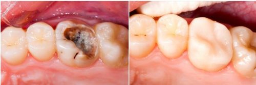 before after-16